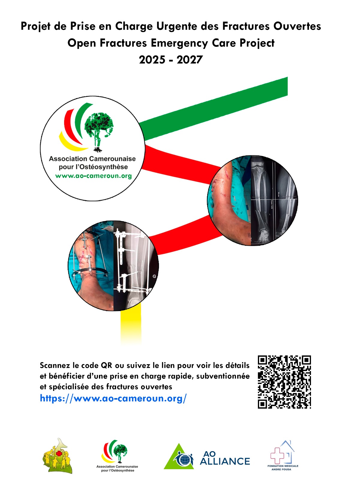 Prise en charge urgente des fractures